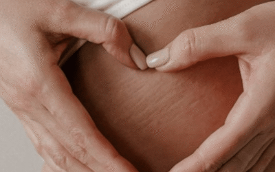 Comment diminuer la cellulite avant l’été ? Les solutions dermo‑esthétiques à Béziers